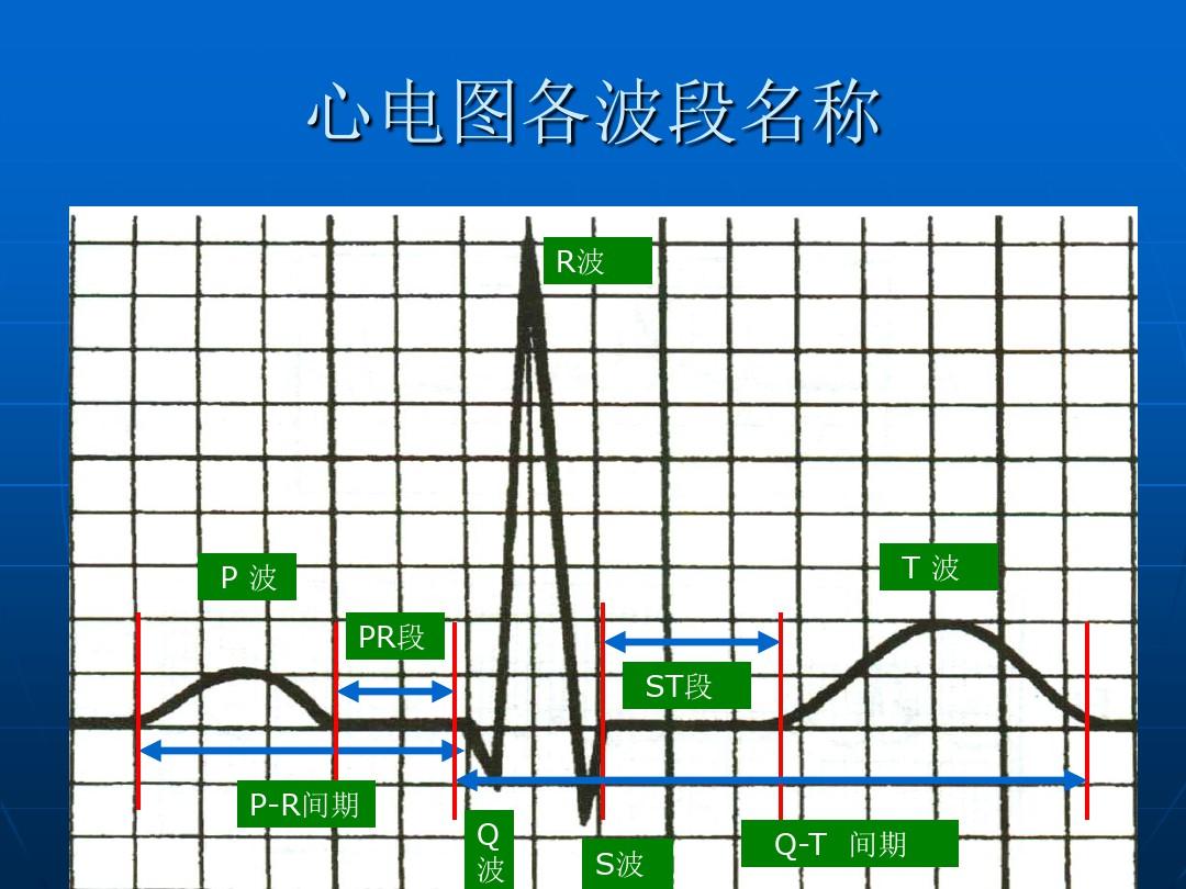 胃痛、牙痛、拉肚子……为什么去医院还要做心电图检查？