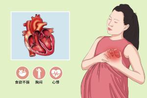 孕期常做心电图，预防妊娠合并心脏病！