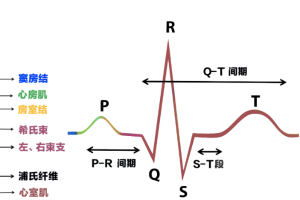 动态心电图与普通心电图有什么区别？
