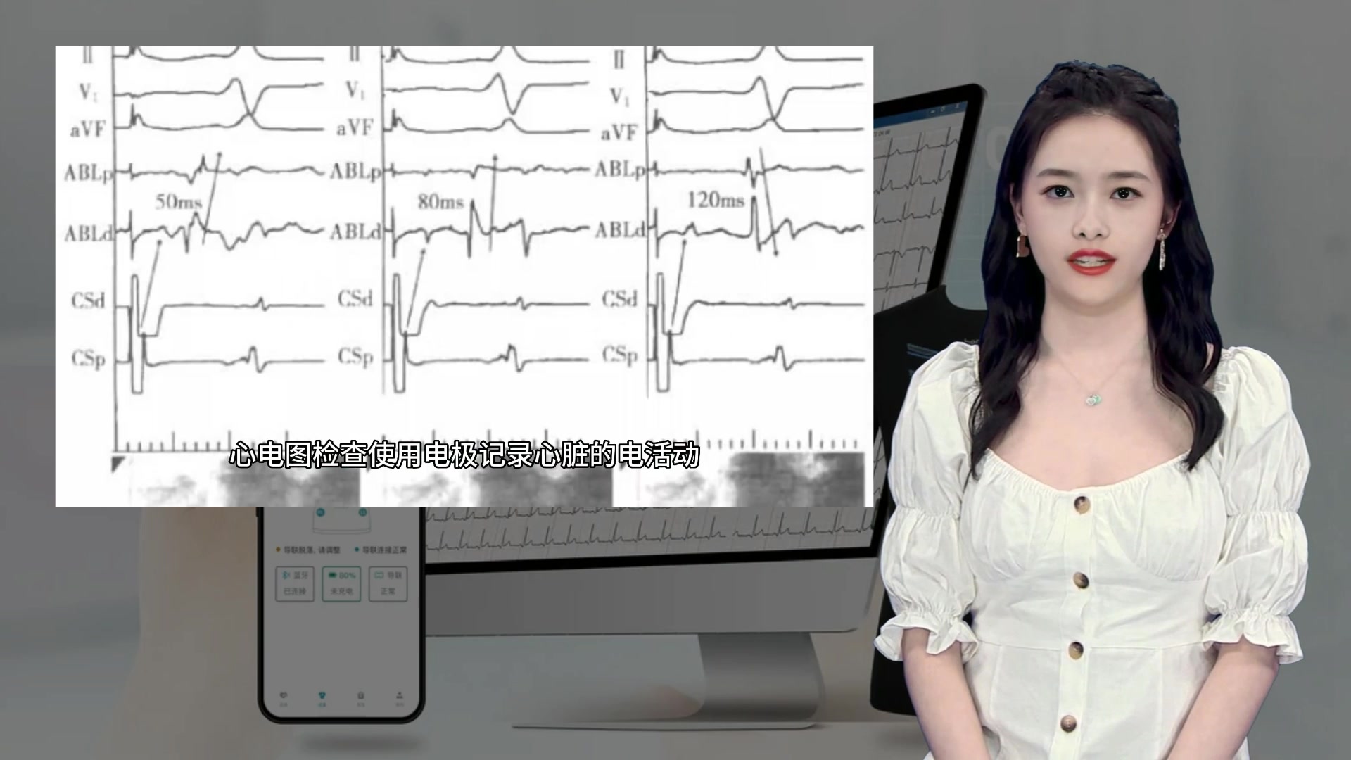 心血管说第二期：心电图是如何诊断心肌缺血的？